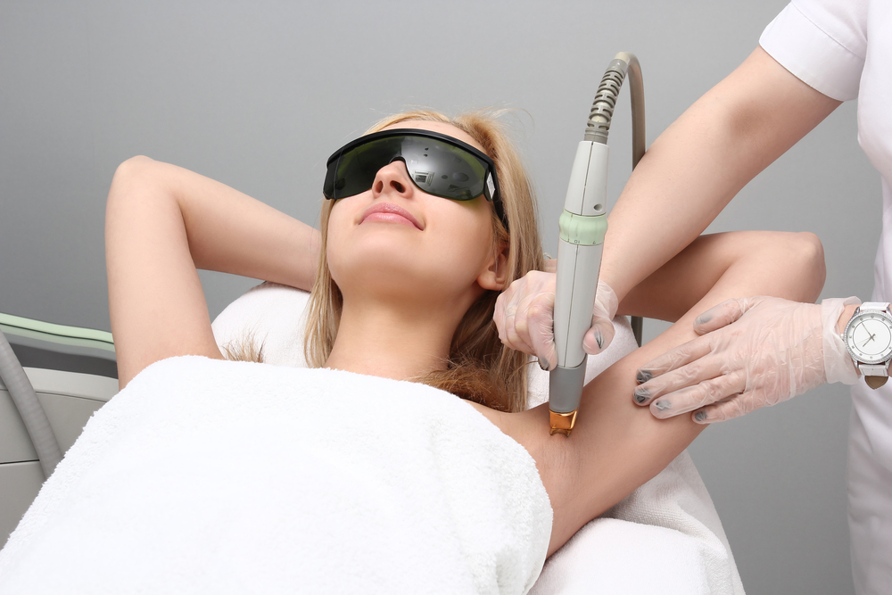 underarm laser hair removal