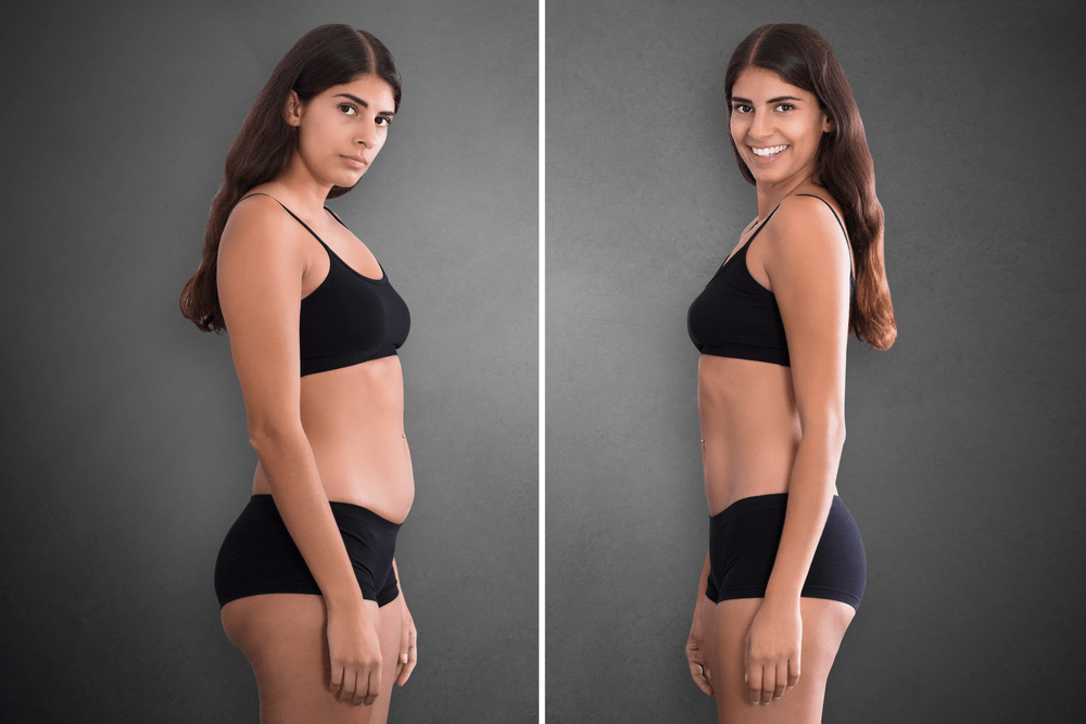 weight loss treatment cost in hyderabad