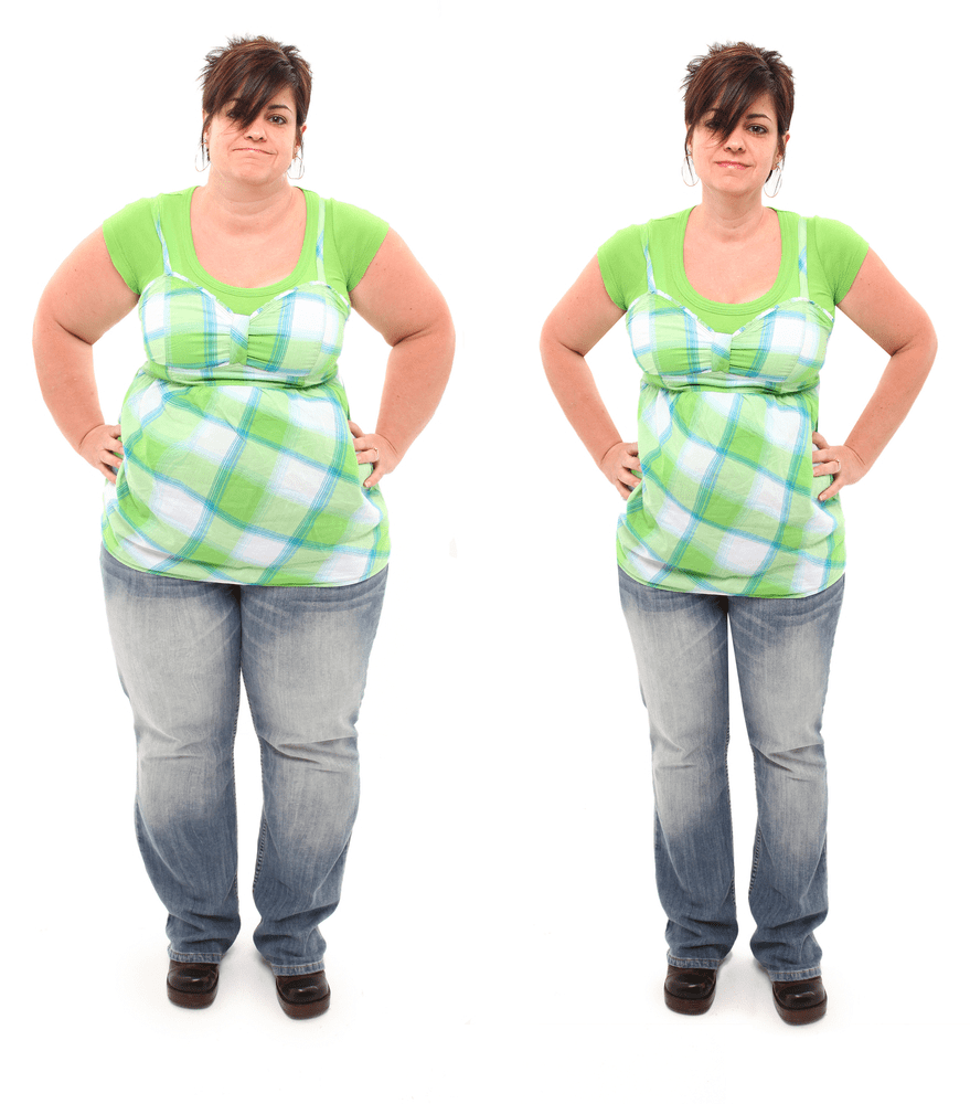 weight loss treatment in hyderabad