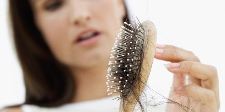 Hair loss Treatment in Hyderabad