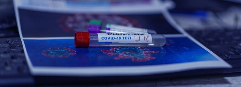 Covid 19 RT PCR Test In Chennai