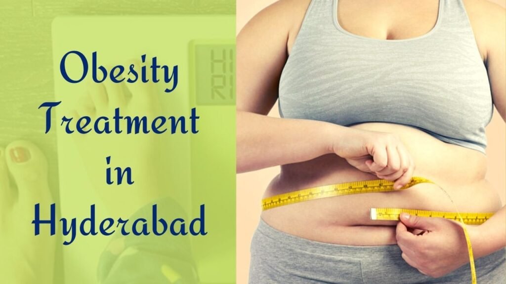 Obesity Treatment in Hyderabad