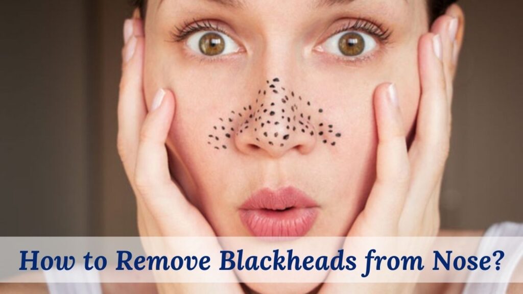 How to Remove Blackheads from Nose