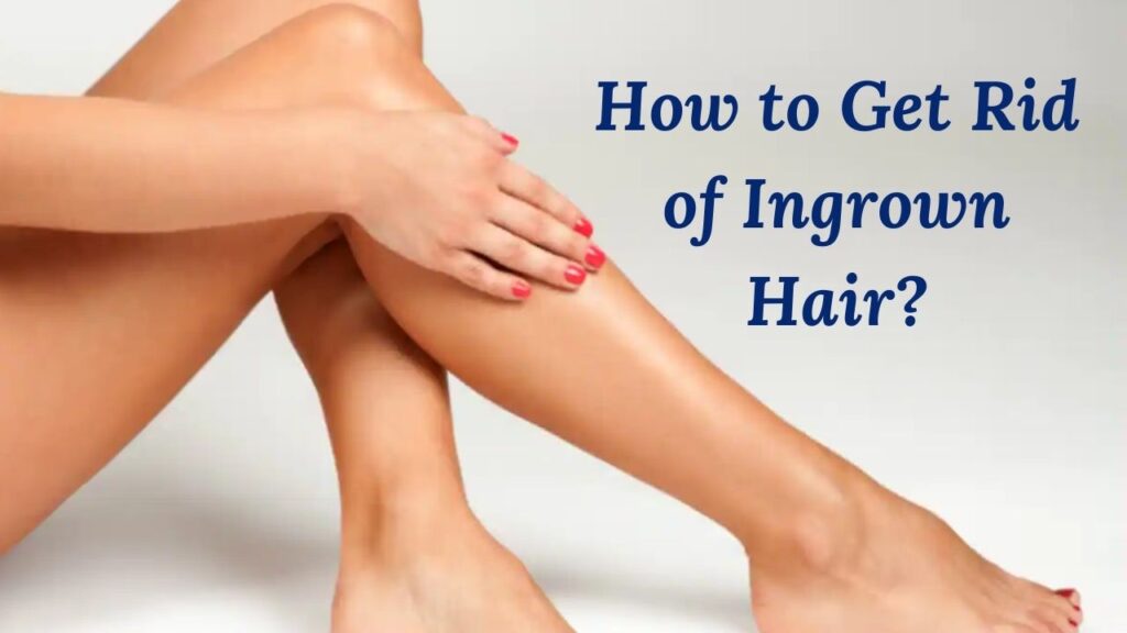 How to Get Rid of Ingrown Hair