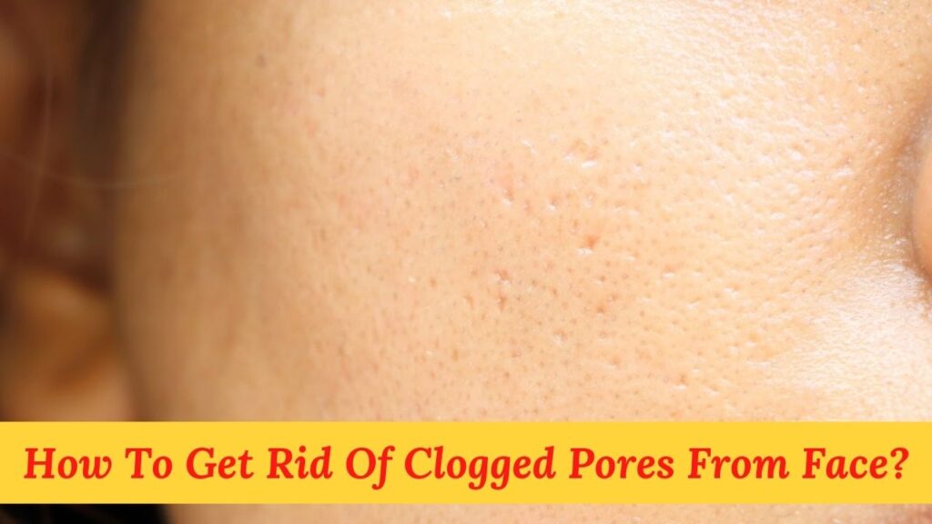 Get Rid Of Clogged Pores From Face
