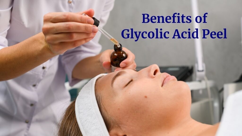 Benefits of Glycolic Acid Peel for Acne