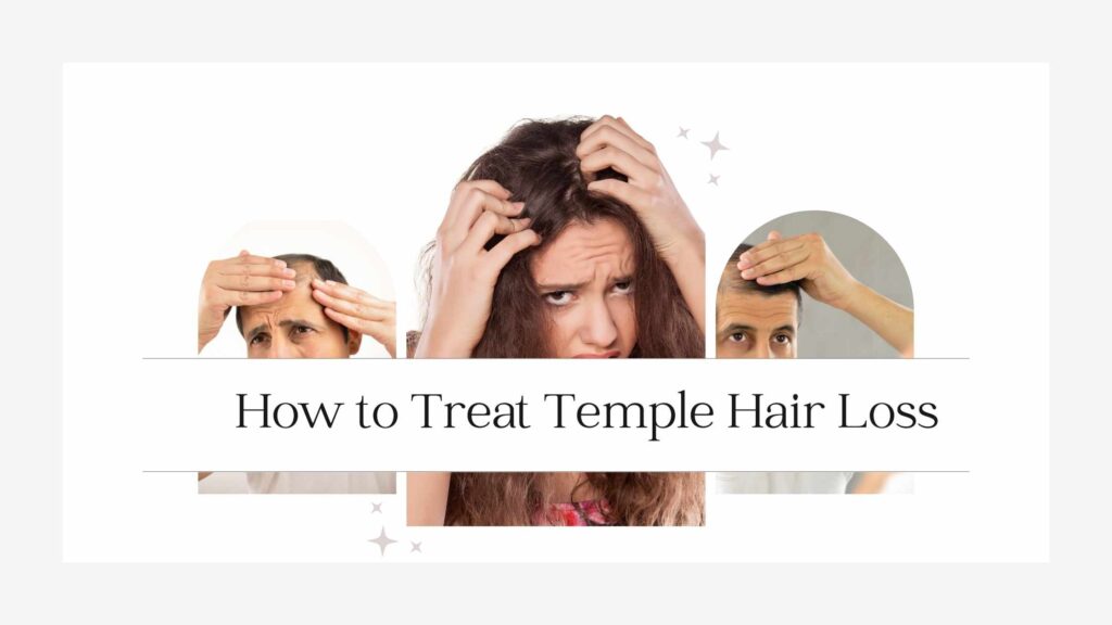 How to Treat Temple Hair Loss