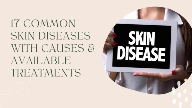 17 Common Skin Diseases with Causes & Available Treatments
