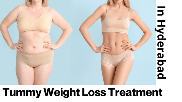 Tummy Weight Loss Treatment In Hyderabad