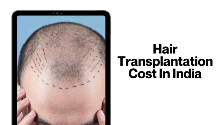 Hair Transplantation Cost In India