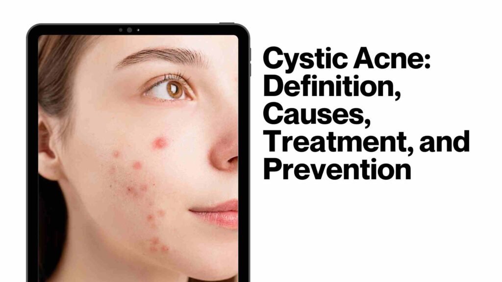 Cystic Acne Definition Causes Treatment And Prevention 