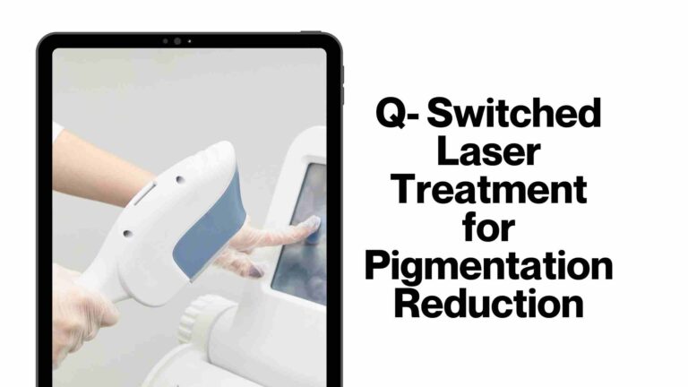 Q- Switched Laser Treatment for Pigmentation Reduction