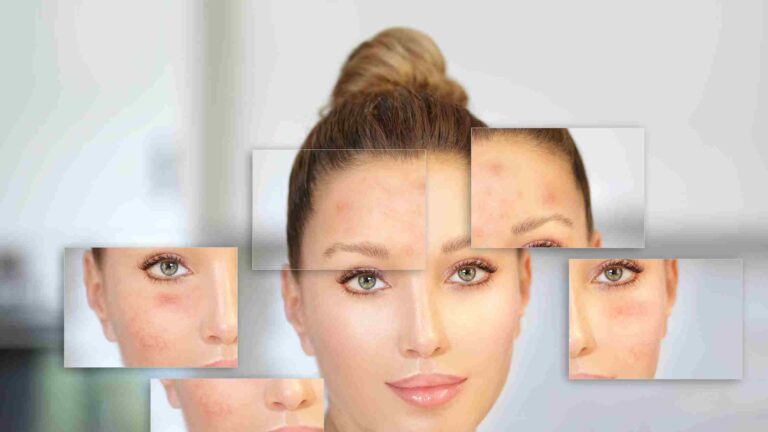 How Much Does Scar Removal Cost In India?