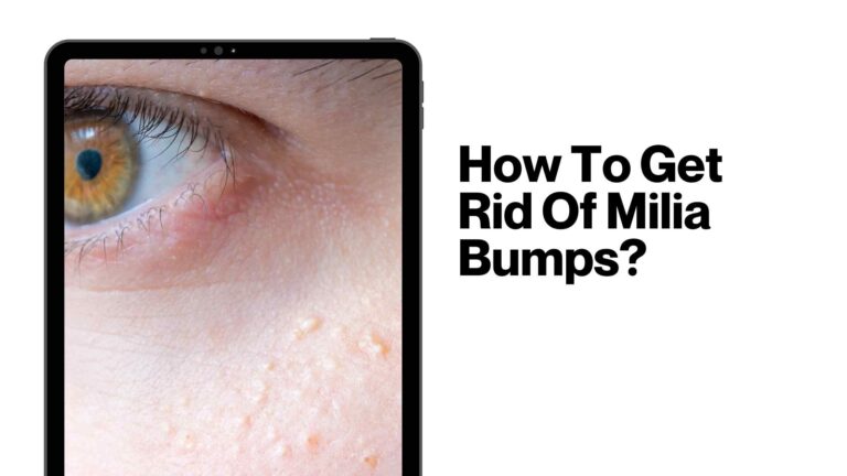 How To Get Rid Of Milia Bumps?