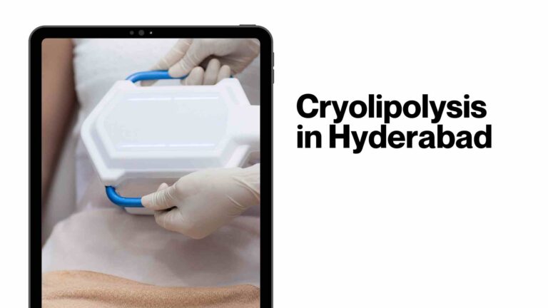 Everything You Need To Know About the New Non-invasive Fat Reduction Treatment: Cryolipolysis in Hyderabad- The Procedure, Cost, and More