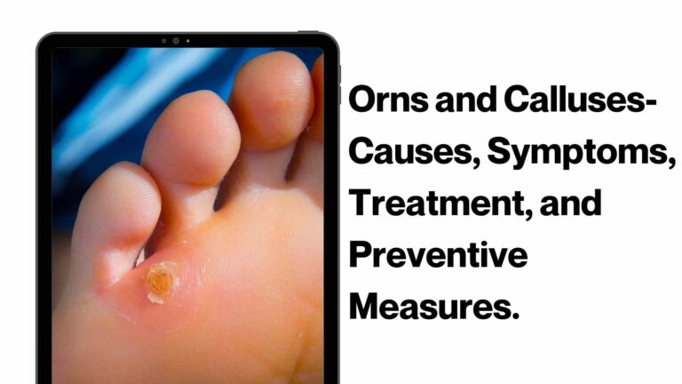 Orns and Calluses- Causes, Symptoms, Treatment, and Preventive Measures. 