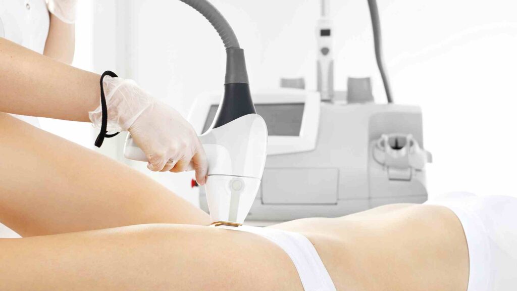 How much does bikini laser hair removal cost in Hyderabad?
