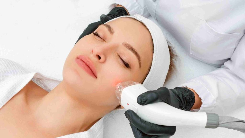 laser therapy for acne