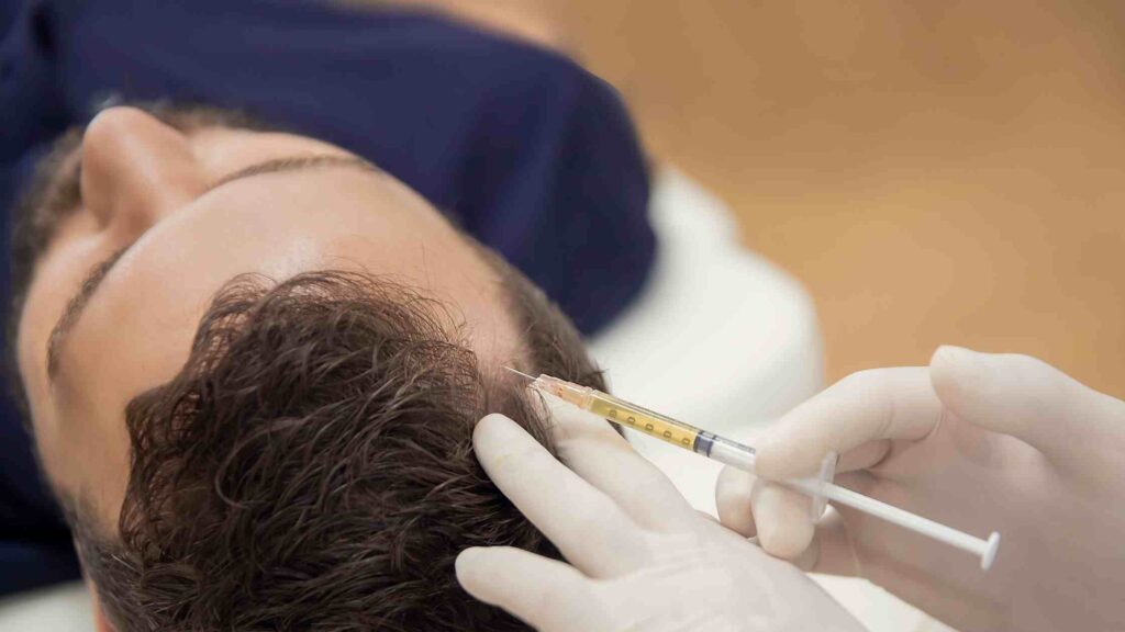 prp hair loss treatment in india