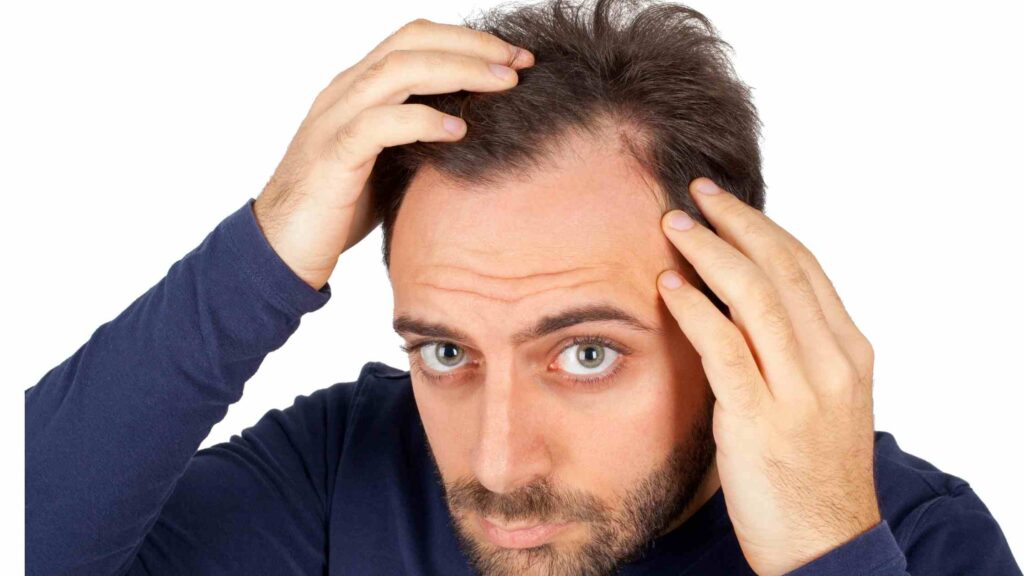 Causes Of Hair Loss In Teenagers