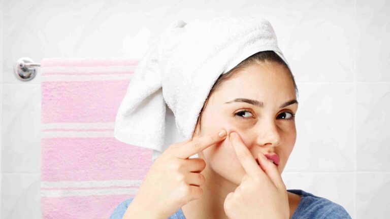 What Are Blind Pimples? How to Get Rid of Blind Pimples?