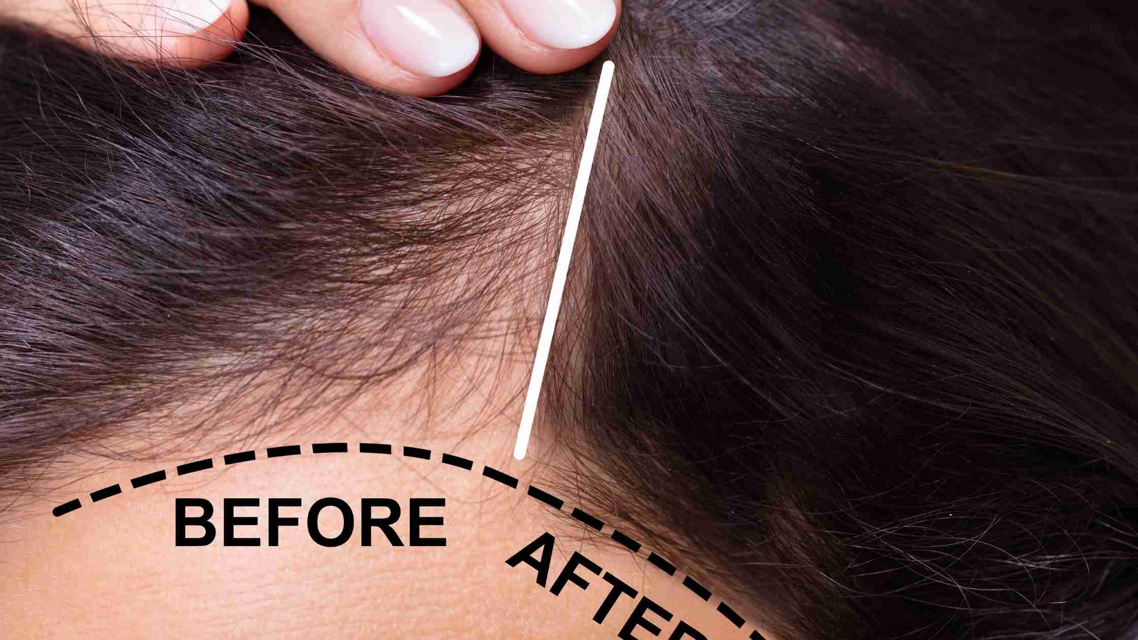 Keratin Hair Treatment Hyderabad Guntur Vijayawada Vizag