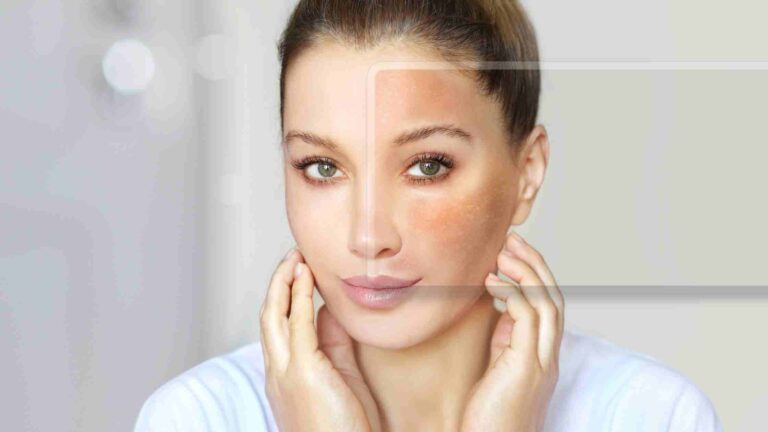 What Is Skin Polishing? How Is It Done?